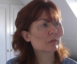 Wajah Wanita Ini Malah Penyok Setelah Suntik Filler