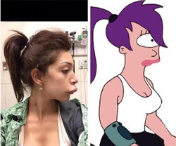 Penampilan Baru Bintang Porno Farrah Pasca Bibirnya Jontor Karena Implan