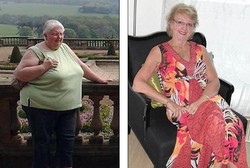 Kisah Linda, 20 Tahun Jarang Mandi karena Takut Nyangkut di Bath Tub