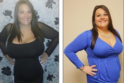 Ukuran Payudara KK Jadi DD, Kini Kim Bebas dari Nyeri Punggung Kronis