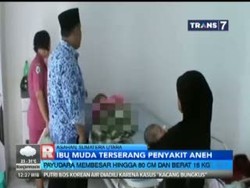 Ibu Muda Ini Terserang Penyakit Aneh, Payudaranya Membesar hingga 80 Cm