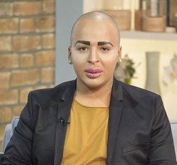 Setelah Operasi Plastik Demi Mirip Kim Kardashian, Pria Ini Ingin Perbesar Bokong