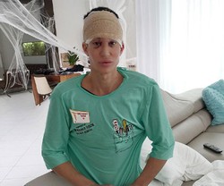 Pria Mirip Ken Barbie Jalani Operasi Kecantikan yang Berisiko Kebutaan