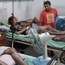 Elpiji 3Kg Bocor, Enam Karyawan Angkringan Melepuh