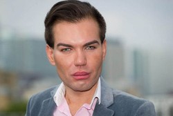 Terobsesi pada Pacar Barbie, Pria Ini Rela 30 Kali Operasi Permak Tubuh