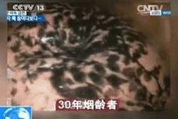 Bikin Perokok Kapok, Tiongkok Bikin Iklan Paru-paru Rusak