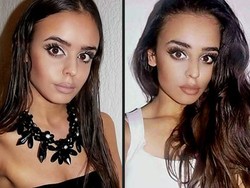 Duh! Model Kroasia Tusuk Saudari Kembarnya Gara-gara Cowok