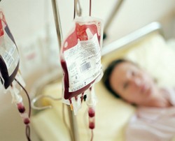 Krim Wajah dengan Kandungan Darah Manusia Jadi Tren Kecantikan Terbaru