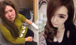 Tak Secantik di Internet, Gadis Ini Dianiaya Teman Kencan