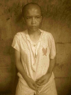 Astaga! Wanita ini Disiksa Ibu Tiri Bertahun-tahun, Pernah juga Disetrika