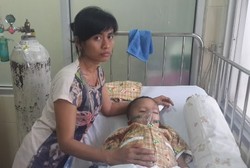 Bocah Riyanti, Pasien Hidrosefalus yang Sudah 2 Minggu Belum Dapat ICU