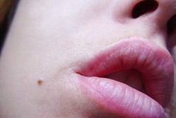 Adakah Makna di Balik Keberadaan Tahi Lalat?