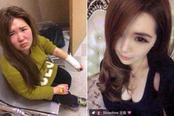 Duh! Wanita Ini Dipukul Pasangan Kencan Online karena Wajah Tak Mirip Foto