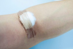 Kulit Orang Mati Dipanen dan Dijadikan Penyembuh Luka dan Borok