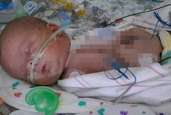 Gangguan Jantung Saat Lahir, Bayi 6 Hari Jalani Transplantasi Jantung
