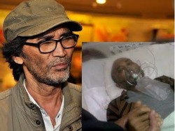 Kena Kanker, Ini Kondisi Terakhir Alex Komang Lewat Foto