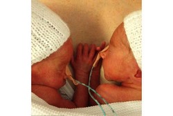 So Sweet! Bayi Kembar Ini Saling Berpegangan ketika Disatukan Kembali