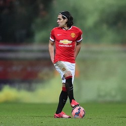 Falcao Tertekan di MU karena Kontraknya