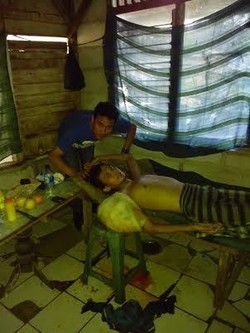 Terserang Tumor, Pemuda dari Keluarga Miskin di Tangerang ini Amat Butuh Pertolongan