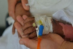 Bukan Terbakar, Kulit Bayi Ini Gosong dan Mengelupas karena Sakit Langka