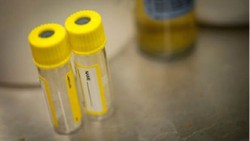 Mengintip Kerja Ahli Bedah Forensik