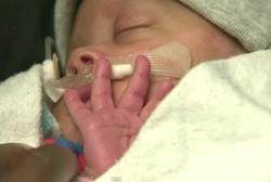 Bayi Prematur Ini Lahir dengan Kantong Ketuban Masih Utuh