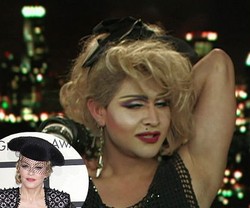 Adam Habiskan Rp 2,3 Miliar untuk Operasi Plastik Agar Mirip Madonna