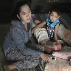 Belasan Warga di Jember Luka Diserang Kera Liar