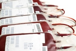 Diet Golongan Darah Sedang Ngetrend, Begini Tanggapan Dokter Gizi