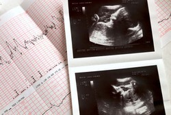 Selain Sehatkan Mata, Vitamin A Juga Bermanfaat untuk Perkembangan Embrio