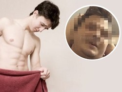 Fakta-fakta Soal Presenter yang Testisnya Hilang Usai Selingkuh