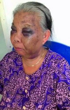 Duh! Pembantu Tua Pak Polisi Ini Matanya Lebam, Diduga Dianiaya