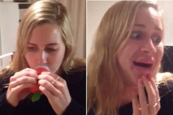 Ingin Tampil Seksi Mirip Kylie Jenner, Bibir Wanita Ini Malah Jontor