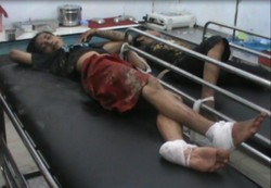 Penjambret di Makassar Diamuk Massa, Motornya Dibakar