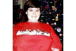 Konsumsi Obat Autisme, Payudara Pria Ini Tumbuh Menjadi Ukuran 46DD