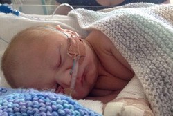 Jantungnya Sempat Tak Berdetak 8 Menit Setelah Dilahirkan, Bayi Ini Selamat