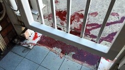 Sebelum Teror Darah, KJRI Sydney Sudah 2 Kali Diteror