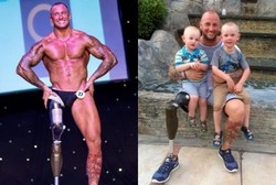 Kehilangan Kaki Kanan di Perang Afganistan, Tentara Ini Jadi Bodybuilder