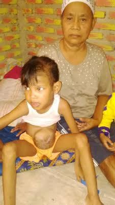 Anak Yatim dari Keluarga Miskin di Bekasi ini Sakit,Tak Punya Biaya Berobat