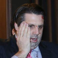 Dubes AS Diserang, Presiden Park: Ini Serangan Terhadap Aliansi Korsel-AS