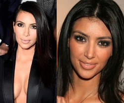 Sekarang Flawless, Dulu Seluruh Tubuh Kim Kardashian Berbulu