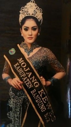 Dianiaya Fotografer, Ayu Kubur Mimpinya Menjadi Model dan Pramugari