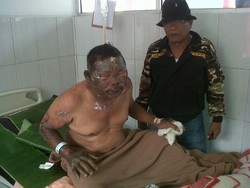 Dipicu Perebutan Lapak Bongkar Muat, Gultom Disiram Bensin dan Dibakar