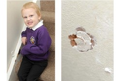 Idap Pica, Bocah 5 Tahun Ini Hobi Makan Pasir, Lumpur, dan Lumut