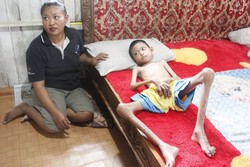 Kisah Rizki, Bocah yang Kurus Kering dan Lumpuh karena Penyakit Langka