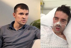 Pria Ini Kena Alzheimer di Usia Muda Karena Mutasi Gen Langka