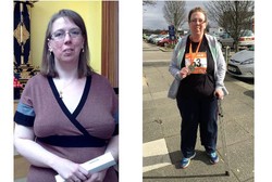 Berkat Insting Suami, Perempuan yang Didiagnosis Mati Otak Ini Bisa Pulih