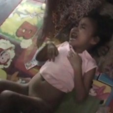 Tolong Pak Bupati, Bocah Pasuruan ini Terluka Bakar Tak Bisa Berobat