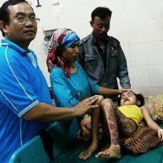 Bocah Pasuruan yang Terluka Bakar Akhirnya Dibawa ke RSUD Bangil