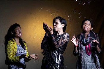 Wajah Bekas Terkena Asam, Wanita Ini Tebar Senyuman di Depan Kamera